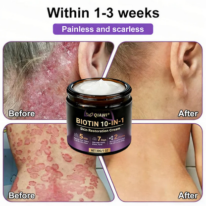 Made and Shipped from USA ✨Orbipaw® Biotin 10-in-1 Skin Restoration Cream 🍀