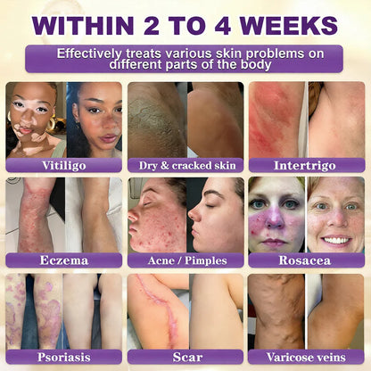 Made and Shipped from USA ✨Orbipaw® Biotin 10-in-1 Skin Restoration Cream 🍀