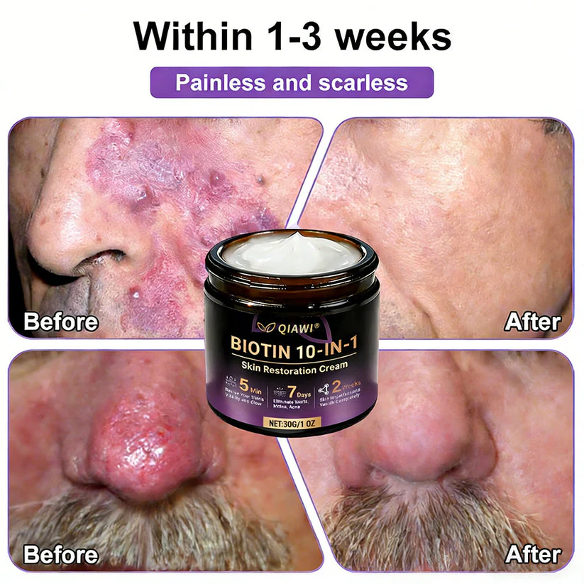 Made and Shipped from USA ✨Orbipaw® Biotin 10-in-1 Skin Restoration Cream 🍀